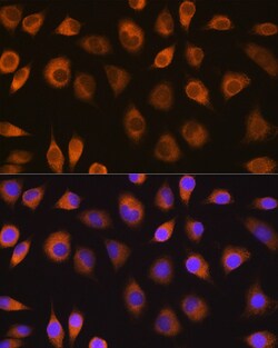 Invitrogen SEL1L Polyclonal Antibody 100 &mu;L; Unconjugated:Antibodies,