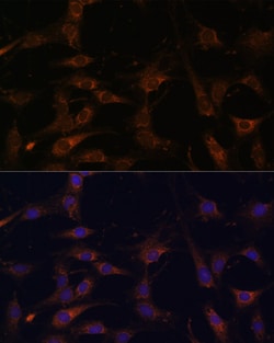 Invitrogen RAB21 Polyclonal Antibody 100 &mu;L; Unconjugated:Antibodies,