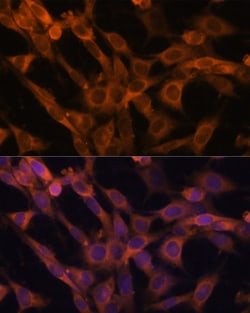 Invitrogen RAB21 Polyclonal Antibody 100 &mu;L; Unconjugated:Antibodies,