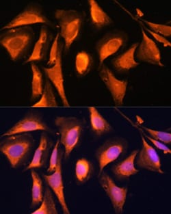 Invitrogen RAB21 Polyclonal Antibody 100 &mu;L; Unconjugated:Antibodies,