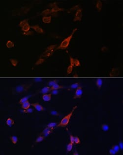 Invitrogen RAB21 Polyclonal Antibody 100 &mu;L; Unconjugated:Antibodies,
