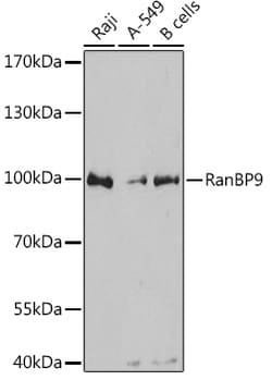Invitrogen RANBP9 Polyclonal Antibody 100 &mu;L; Unconjugated:Antibodies,