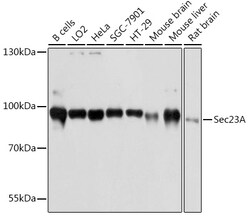 Invitrogen SEC23A Polyclonal Antibody 100 &mu;L; Unconjugated:Antibodies,