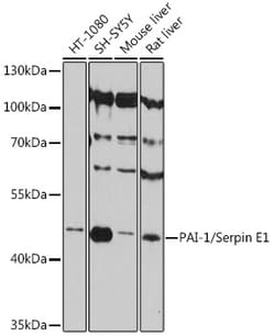 Invitrogen PAI1 Polyclonal Antibody 100 &mu;L; Unconjugated:Antibodies,