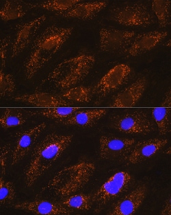 Invitrogen NDUFA8 Polyclonal Antibody 100 &mu;L; Unconjugated:Antibodies,
