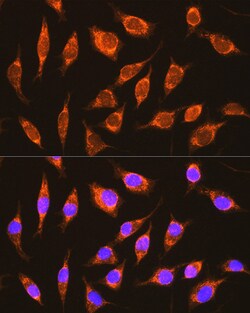 Invitrogen NDUFA8 Polyclonal Antibody 100 &mu;L; Unconjugated:Antibodies,
