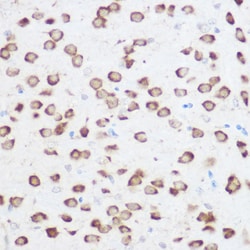 Invitrogen RPS24 Polyclonal Antibody 100 &mu;L; Unconjugated:Antibodies,