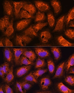 Invitrogen ACAP2 Polyclonal Antibody 100 &mu;L | Buy Online | Invitrogen&trade; | Fisher Scientific