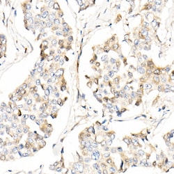 Invitrogen AMID Polyclonal Antibody 100 &mu;L; Unconjugated:Antibodies,