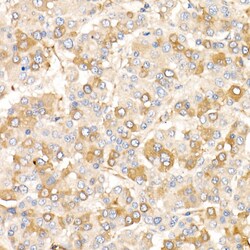 Invitrogen AMID Polyclonal Antibody 100 &mu;L; Unconjugated:Antibodies,