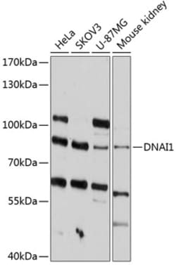 Invitrogen DNAI1 Polyclonal Antibody 100 &mu;L; Unconjugated:Antikroppar