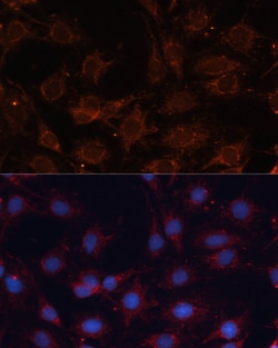 Invitrogen SLC25A24 Polyclonal Antibody 100 &mu;L; Unconjugated:Antibodies,