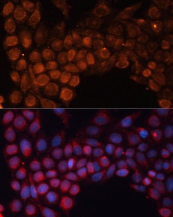 Invitrogen SLC25A24 Polyclonal Antibody 100 &mu;L; Unconjugated:Antibodies,