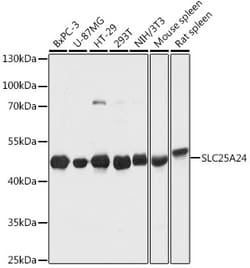 Invitrogen SLC25A24 Polyclonal Antibody 100 &mu;L; Unconjugated:Antibodies,