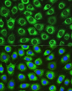 Invitrogen DNAJC10 Polyclonal Antibody 100 &mu;L; Unconjugated:Antibodies,