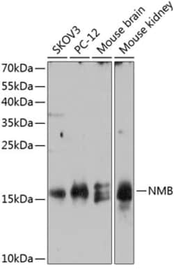 Invitrogen NMB Polyclonal Antibody 100 &mu;L; Unconjugated:Antibodies,