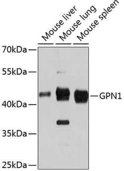 Invitrogen GPN1 Polyclonal Antibody 100 &mu;L; Unconjugated:Antibodies,