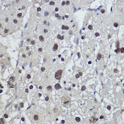 Invitrogen TSPYL1 Polyclonal Antibody 100 &mu;L; Unconjugated:Antibodies,