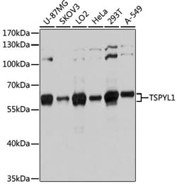 Invitrogen TSPYL1 Polyclonal Antibody 100 &mu;L; Unconjugated:Antibodies,