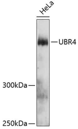Invitrogen UBR4 Polyclonal Antibody 100 &mu;L | Buy Online | Invitrogen&trade; | Fisher Scientific
