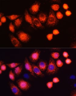 Invitrogen H-Ras Polyclonal Antibody 100 &mu;L; Unconjugated:Antibodies,