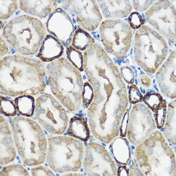 Invitrogen IP6K1 Polyclonal Antibody 100 &mu;L; Unconjugated:Antibodies,