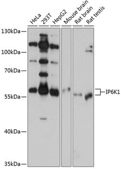 Invitrogen IP6K1 Polyclonal Antibody 100 &mu;L; Unconjugated:Antibodies,