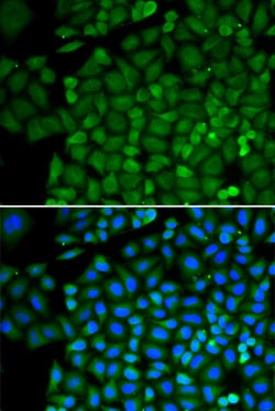Invitrogen SELENBP1 Polyclonal Antibody 100 &mu;L; Unconjugated:Antibodies,