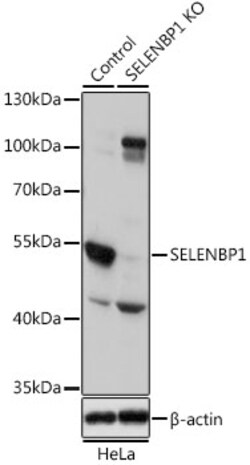 Invitrogen SELENBP1 Polyclonal Antibody 100 &mu;L; Unconjugated:Antibodies,