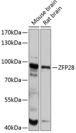 Invitrogen ZFP28 Polyclonal Antibody 100 &mu;L; Unconjugated:Antibodies,
