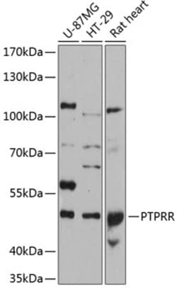 Invitrogen PCPTP1 Polyclonal Antibody 100 &mu;L; Unconjugated:Antibodies,