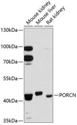 Invitrogen PORCN Polyclonal Antibody 100 &mu;L | Buy Online | Invitrogen&trade; | Fisher Scientific