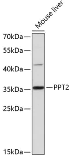 Invitrogen PPT2 Polyclonal Antibody 100 &mu;L; Unconjugated:Antibodies,