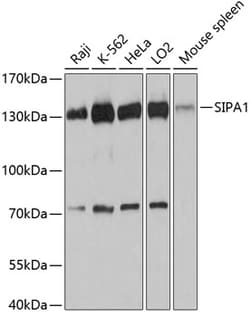 Invitrogen SIPA1 Polyclonal Antibody 100 &mu;L; Unconjugated:Antibodies,