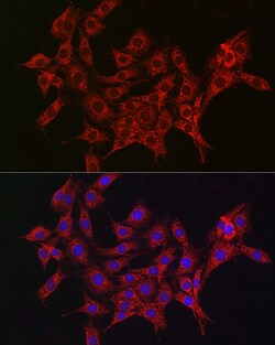 Invitrogen ALDH2 Polyclonal Antibody 100 &mu;L; Unconjugated:Antibodies,