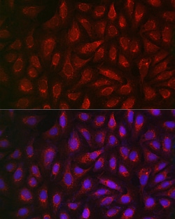 Invitrogen ALDH2 Polyclonal Antibody 100 &mu;L; Unconjugated:Antibodies,