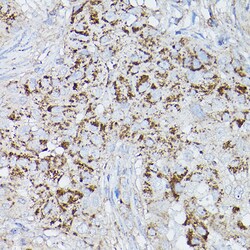 Invitrogen ALDH2 Polyclonal Antibody 100 &mu;L; Unconjugated:Antibodies,