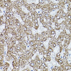 Invitrogen ALDH2 Polyclonal Antibody 100 &mu;L; Unconjugated:Antibodies,