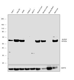 Invitrogen ALDH2 Polyclonal Antibody 100 &mu;L; Unconjugated:Antibodies,