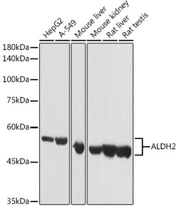 Invitrogen ALDH2 Polyclonal Antibody 100 &mu;L; Unconjugated:Antibodies,