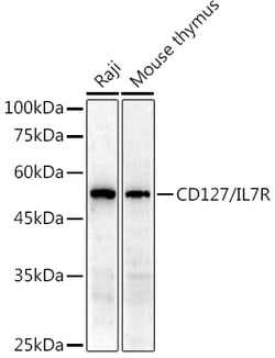Invitrogen CD127 Polyclonal Antibody 100 &mu;L; Unconjugated:Antibodies,