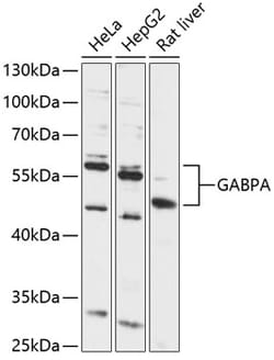 Invitrogen GABPA Polyclonal Antibody 100 &mu;L; Unconjugated:Antibodies,