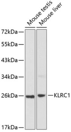Invitrogen NKG2A Polyclonal Antibody 100 &mu;L; Unconjugated:Antibodies,