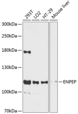Invitrogen CD249 Polyclonal Antibody 100 &mu;L; Unconjugated:Antibodies,