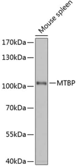 Invitrogen MTBP Polyclonal Antibody 100 &mu;L; Unconjugated:Antibodies,