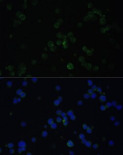 Invitrogen CD3d Polyclonal Antibody 100 &mu;L; Unconjugated:Antibodies,