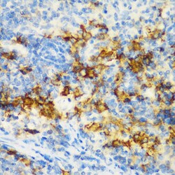 Invitrogen CD3d Polyclonal Antibody 100 &mu;L; Unconjugated:Antibodies,