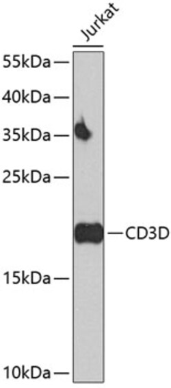 Invitrogen CD3d Polyclonal Antibody 100 &mu;L; Unconjugated:Antibodies,