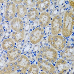 Invitrogen Acid Phosphatase 1 Polyclonal Antibody 100 &mu;L; Unconjugated:Antibodies,