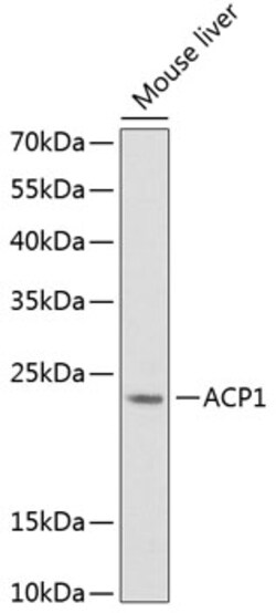 Invitrogen Acid Phosphatase 1 Polyclonal Antibody 100 &mu;L; Unconjugated:Antibodies,